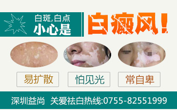 深圳哪个医院有美国三维皮肤ct检验设备